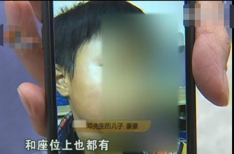 孩子校車上被打耳光，父親找到學校要說法，校長：老師心情不好